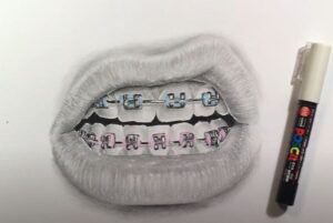 How to draw Braces on Teeth