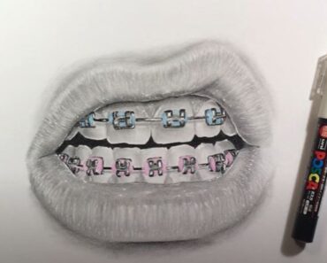How to draw Braces on Teeth Step by Step